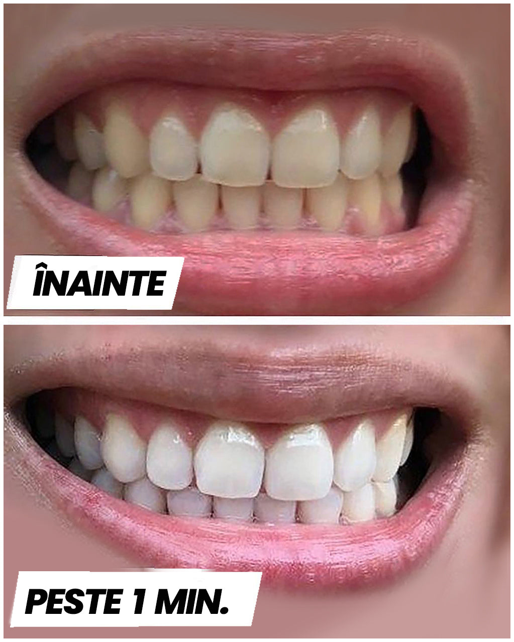 Teeth Whitening™ Strips